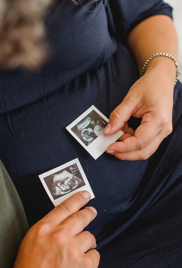 The Gender Reveal Party can take place as soon as the doctor has confirmed the sex of the child with an ultrasound image.